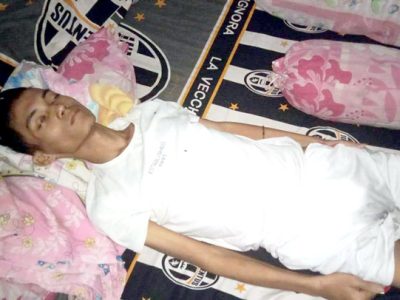 Muhammad Fiki (23) dari keluarga miskin terbaring koma di rumah hampir berulan bulan, akibat penyakit yang diidapnya