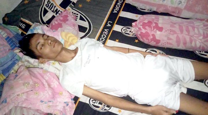 Muhammad Fiki (23) dari keluarga miskin terbaring koma di rumah hampir berulan bulan, akibat penyakit yang diidapnya